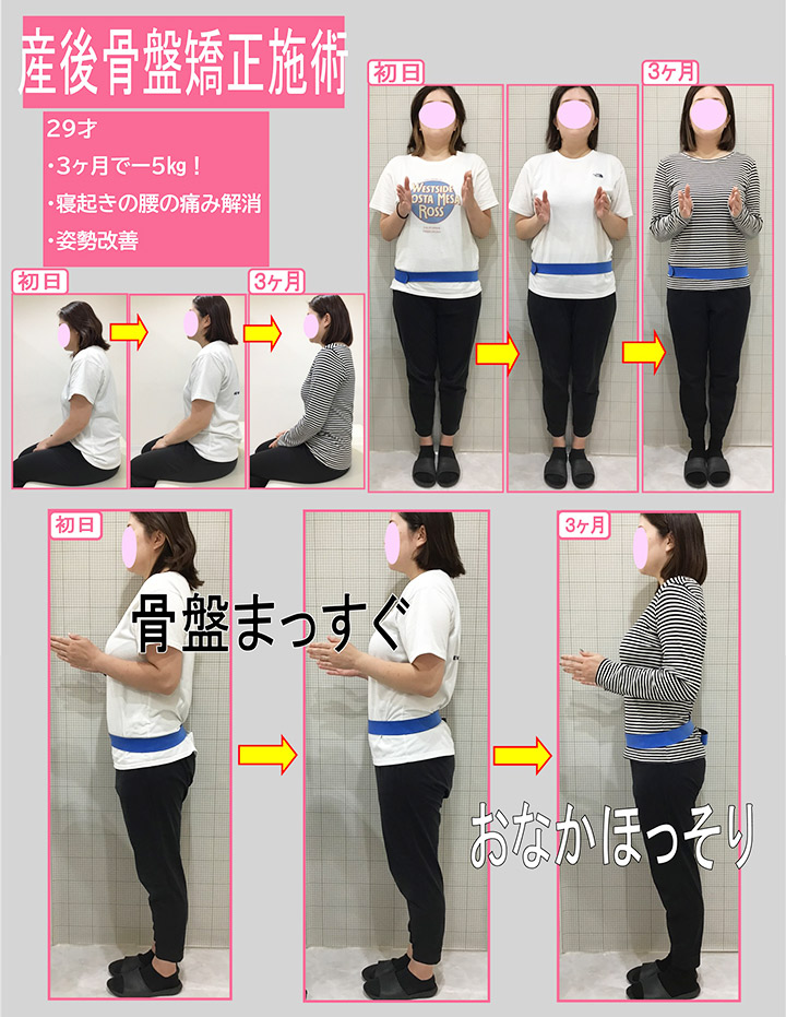 ビフォーアフター