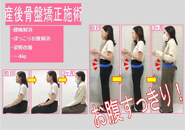 ビフォーアフター