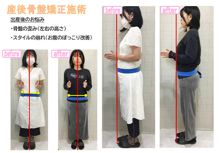 ビフォーアフター